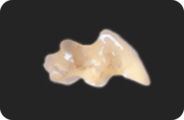 オールセラミック