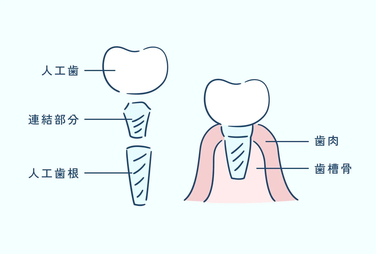 歯を長持ちさせるために。予防歯科に力を入れています。